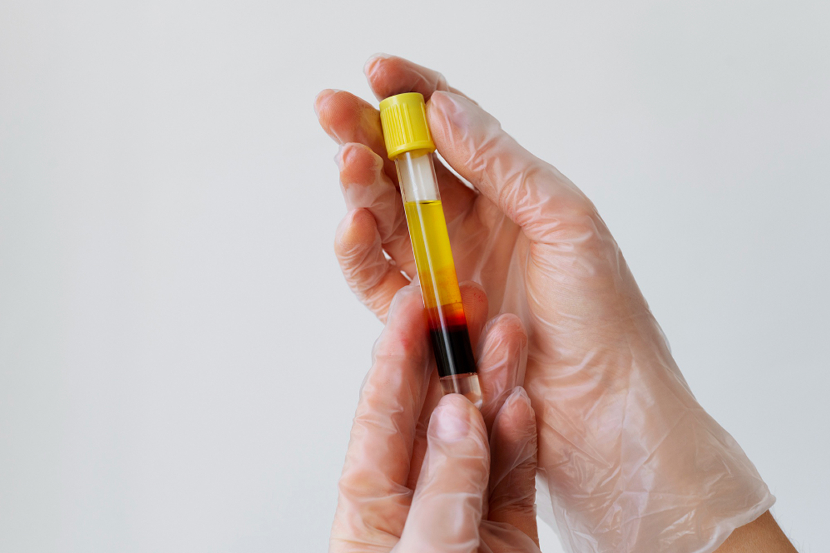sample kolesterol di dalam tube